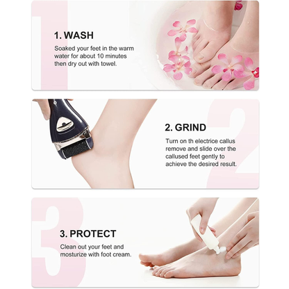Electric Callus Remover (Rechargeable)