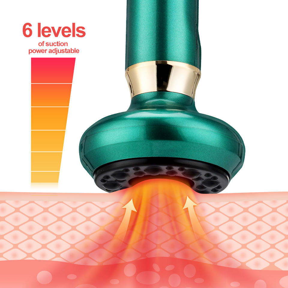 Electric Cupping Massager 12 Gear Suction and Heating