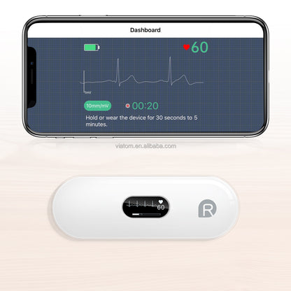 Wellue DuoEK™ S Personal ECG Monitor – Medical-Grade Handheld EKG with Real-Time OLED Display & AI Analysis – Detects AFib, Arrhythmia & Heart Pause – No Subscription, Free App for iOS & Android