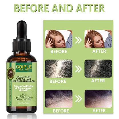 Anti Hair Loss Care for Strengthening Scalp Fast Growth Oil (Pack of 1) 30ml